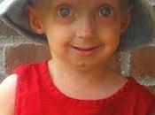 Rarología: Progeria