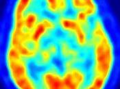 Publicado 'PLoS Biology": cerebro humano favorece creatividad toma decisiones