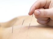 estudio muestra acupuntura funciona, noticia respecto dice contrario