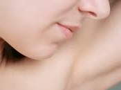 Depilación Definitiva