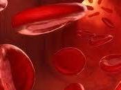 ¿Qué significa tener envenenamiento sangre?