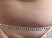 Dietas pueden peligrosas para personas enfermedad renal