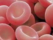 Niveles bajos hierro podrían aumentar riesgo coágulos sanguíneos