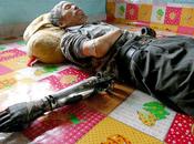 Imagen: Hombre Chino Inventa Manos Biónicas