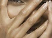 Melasma toda verdad