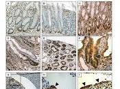 Descubren Proteína Repara Pared Intestinal