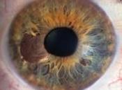 Enfermedades ojos
