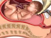 parto cesárea podría bebés obesos