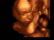 Silencio, música sonrisas