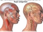 ¿Qué duele cuando cabeza?