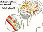 ¿Cómo prevenir ACV?