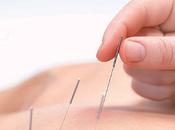 acupuntura podría aliviar síntomas boca seca tras cáncer