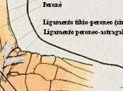 Esguince Tobillo
