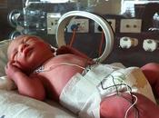 Drenar cordón umbilical beneficia recién nacido