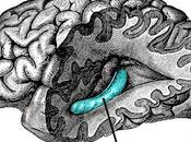 Implantan dispositivo cerebro paciente esperanza frenar Alzheimer