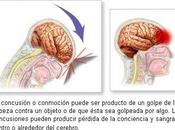 conmociones cerebrales pueden causar interrupciones