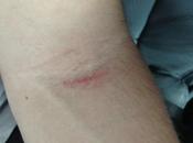 ¡Liam Payne sale herido tras ataque Directioners!