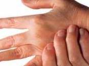 Medicina natural para artrosis