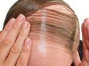 Alimentos contra calvicie, previenen perdida cabello