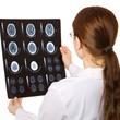 ¿Cuándo solicitar tomografía casos cefalea?