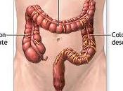 Toxicidad colon