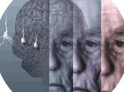 Alzheimer mano –molecular- Esclerosis Múltiple