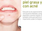 ¿Cómo eliminar puntos negros faciales?