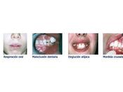 Terapia miofuncional ortodoncia