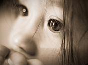 Generalidades sobre cirugía refractiva