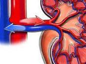 Evitar presencia insuficiencia renal aguda nuestro organismo