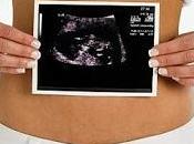 Pielocaliectasia renal feto ecografía prenatal