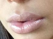 Kardashian, inyectó labios durante embarazo?
