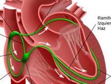 Prevenir arritmias cardiacas equilibrada alimentación