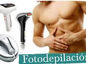 Fotodepilación