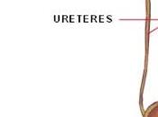 Estenosis ureteral estenosis uretral