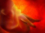 Test prenatal invasivo diagnostica sangre materna alteraciones cromosomicas
