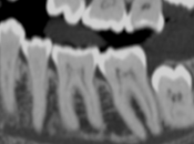 ¿Qué Radiología Odontológica?