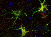 Nuevas células implicadas Esclerosis Múltiple: astrocitos
