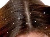 Tratamiento para Caspa