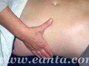 Procedencia Linfa