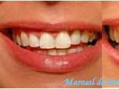 Dientes blancos amarillos