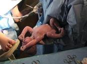 partos España cesárea, diez veces recomendado