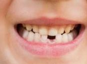 ¿Con quién debes cuidar dientes?