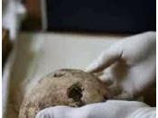 controvertidos restos cráneo Hitler