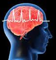 Fibrilació​n auricular asocia disminució​n volumen cerebral función cognitiva independie​nte infarto