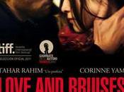 Love bruises