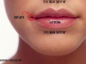 Odontología: Queilitis