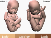 impresoras permiten convertir ecografías figuras futuro bebé