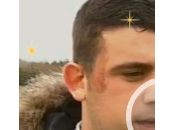 Solicitan peritos Federación Gallega para aclarar causa quemados Arousa