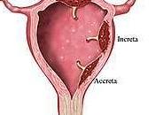 Problemas placenta: Acretismo placenta previa
